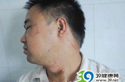 医生遭病人家属暴打 忍着伤疼坚持救人(图)