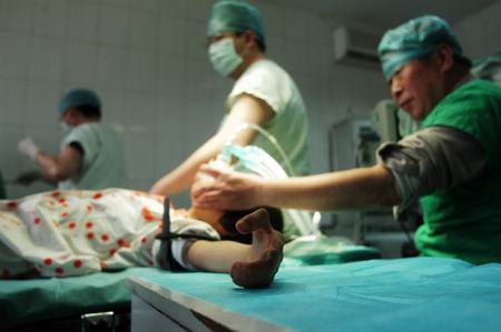 家族遗传病 女孩手指粘连做手术割开指缝(图)