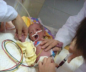 垂危病婴险遭父亲活埋 被弃野外39小时奇迹生还(图)