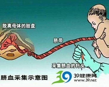脐血库还可不可信？
