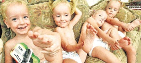 美四胞胎一模一样 母亲为其纹“身份痣”辨认