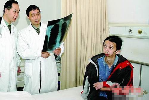 19岁小伙患罕见溶骨症 下巴莫名溶解脸畸形(图)