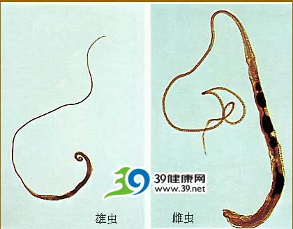 桂冠贡丸被指吃出虫子 网友疑是鞭虫(图)