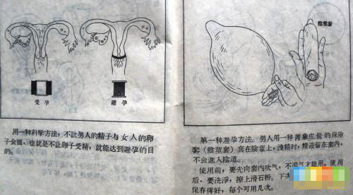 52年前夫妻这样避孕