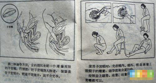 52年前夫妻这样避孕