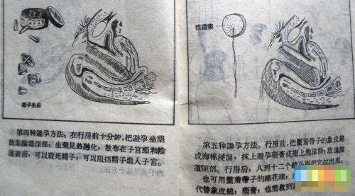 52年前夫妻这样避孕