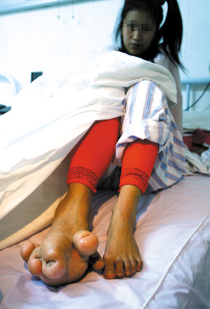 女孩先天巨趾大如足球 为治病委屈嫁人被骗(图)