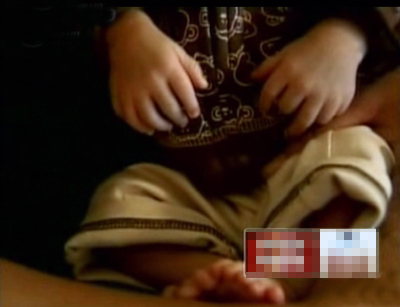 美一罕见多指趾男婴有24根手指和脚趾(图)