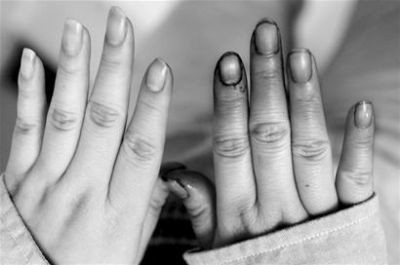 染色黑米流入市场 全家食后腹痛难忍