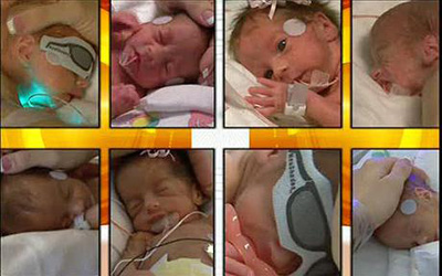 史上第二宗八胞胎在美亮相：相貌可爱很瘦小