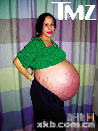 33岁单亲母亲怀孕8胞胎 打破世界纪录(图)