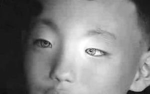 广西“猫眼”男孩瞳孔呈蓝色 具有神奇夜视能