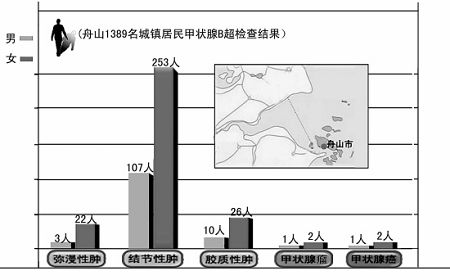 舟山“碘过量”很多脖子粗 一个家族5个甲状腺癌