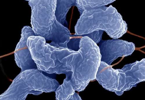 美丽杀手：8种致命病原体显微照片(组图)
