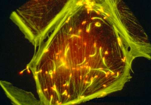 美丽杀手：8种致命病原体显微照片(组图)