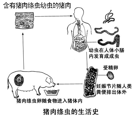 吃烧烤感染绦虫病　口腔瘤内大绦虫长1.5米