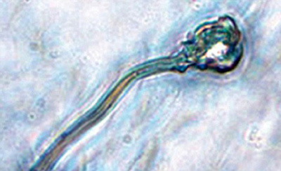 皮肤培育精子 死人也可当爹