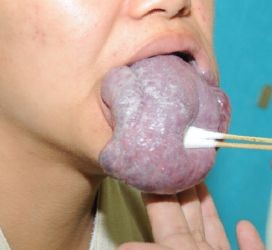 少女长蓝色巨舌尼姑庵内避世6年