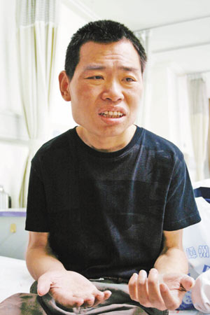 嵊州一男子30年没出汗 源于基因出错