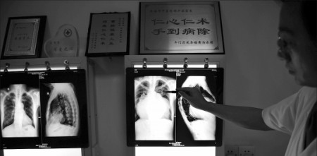 他的心脏比常人大5倍