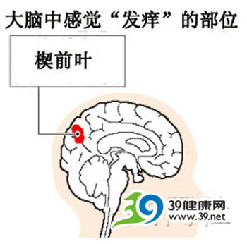 科学家发现大脑中感觉发痒部位 或可研制止痒药