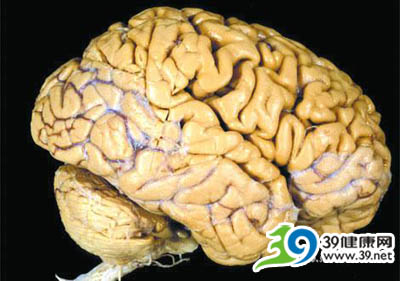 研究发现：精神变态者的大脑构造明显异于常人