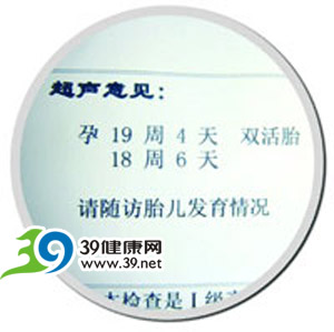 两胎儿孕期差五天 专家怀疑异期复孕(图)