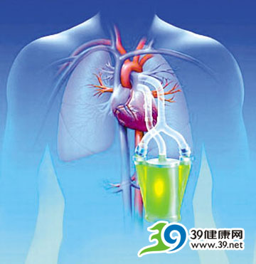 专家发现甲流病毒可伤肺