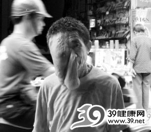 世界上最恐怖的病症(组图)