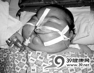 世界上最恐怖的病症(组图)