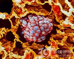 英国科学家破译两种致命癌症基因图谱 全球首次