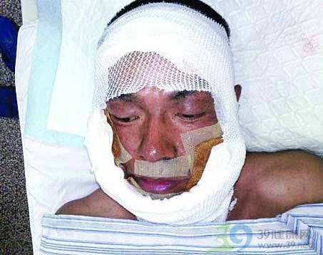 拍戏遭遇意外爆炸被烧伤 演员王挺获赔70万(图)