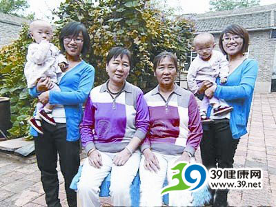 家族出现连续十代传女不传男双胞胎(组图)