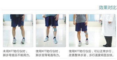 国内首款基于步态分析的足下垂助行仪面世