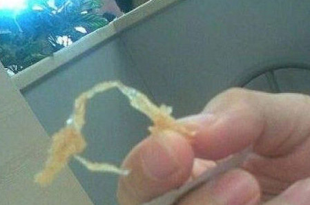 恶心！网友爆吃KFC吃出避孕套