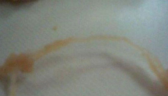 恶心！网友爆吃KFC吃出避孕套