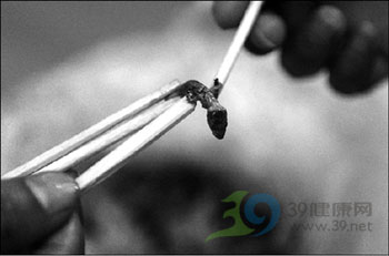 学校食堂用餐 居然吃出“壁虎”