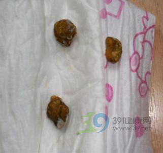 黑新闻：惠氏奶粉致婴儿严重便秘报道后续