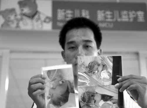 罕见连体婴胸口长双腿 父母为费用发愁(图)