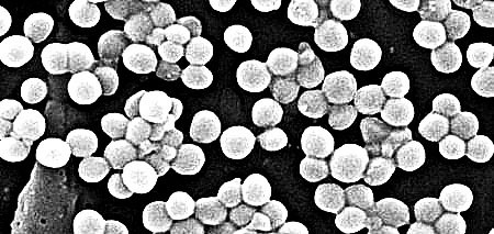 “超级病菌”已致多人死亡 仅两种抗生素对其有效