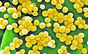 超级细菌几乎可抵御所有抗生素 10年内无药可治