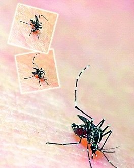 东莞爆发基孔肯雅热疫情 已发现91例疑似病例