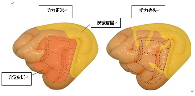 研究称先天耳聋缺陷可通过发达的视觉弥补