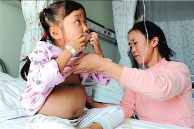 六龄童患怪病肚大如球