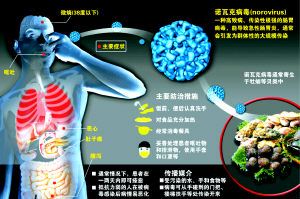 美国第二大县逾百名学生疑似感染诺瓦克病毒