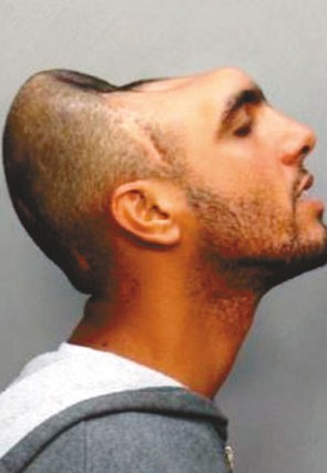 美国囚犯只有半个脑袋走红网络