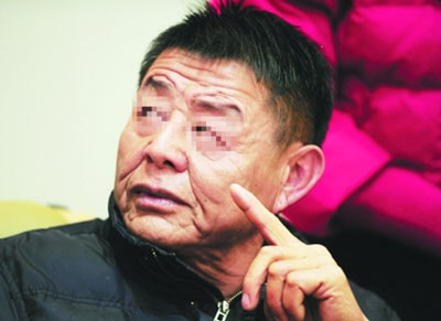 7岁患“皮肤松弛症”一个月变老人 全球20年不足10例
