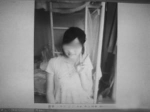 17岁少女接受药物治疗后长胡子(组图)