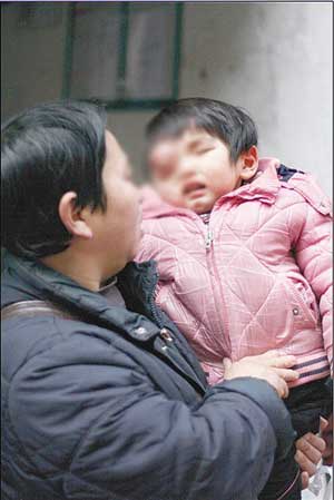 两龄童右眼长肿瘤左眼近失明 不动手术恐没命