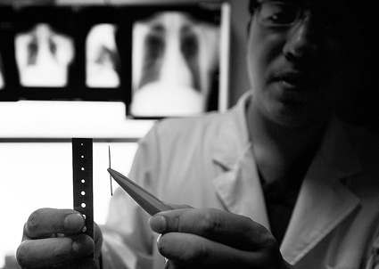 俗话说十指连心,即使是手指头受伤,心里也会觉得痛。而来自宁夏的龚先生心口处扎进去一根针,近3个月却